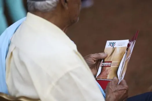 Pesquisadores desenvolvem tratamento natural contra a psoríase