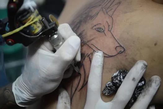 Remoção de tatuagem: Vale mesmo a pena?