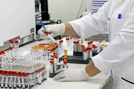 Laboratório da FMABC realiza mais de 6,6 milhões de exames em 2023