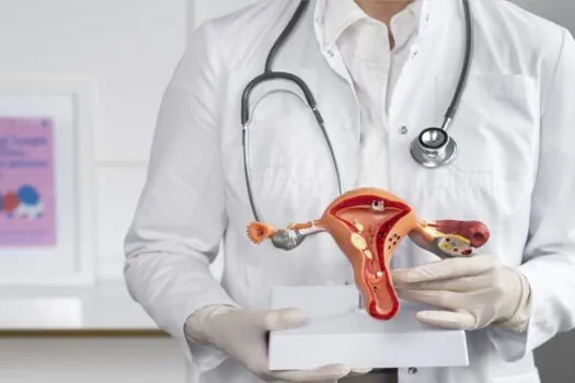 Diagnóstico de endometriose ainda é um desafio para mulheres