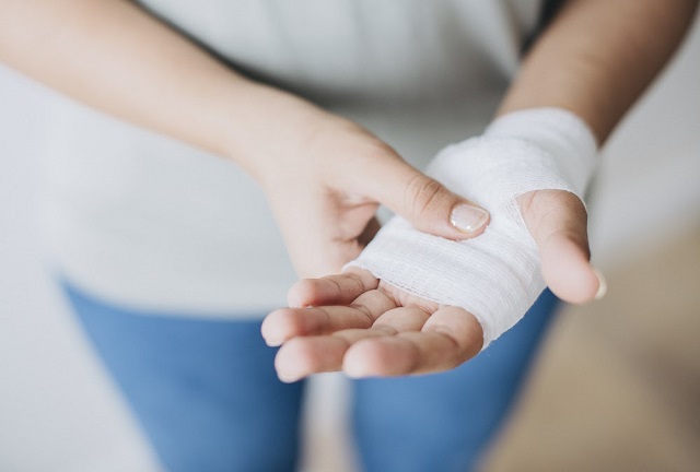 Woman with gauze bandage wrapped around her hand