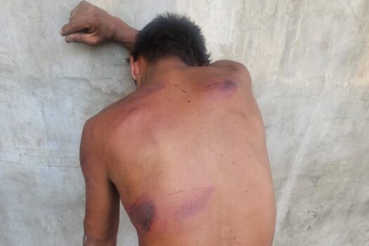 Homem em situação de rua é agredido com facão no entorno do parque Ibirapuera, em SP