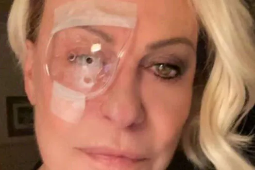 Ana Maria Braga mostra recuperação de cirurgia no olho