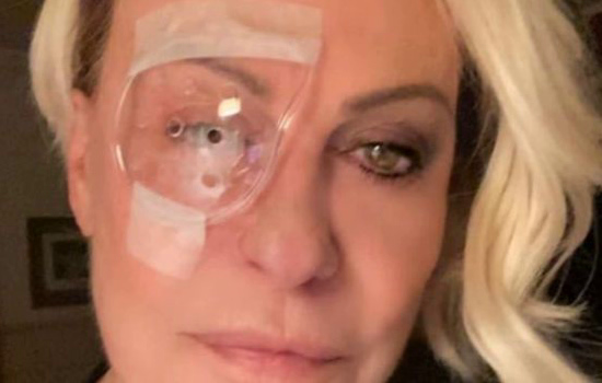 Ana Maria Braga mostra recuperação de cirurgia no olho