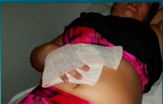Erika Pacheco Pimentel foi esfaqueada na barriga
