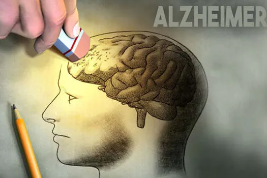 Mais barato, exame prevê diagnóstico de Alzheimer