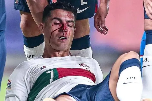 Cristiano Ronaldo agradece apoio de fãs ao se machucar pela seleção portuguesa