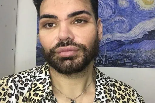 Ator faz mais de 30 cirurgias para se parecer com Ricky Martin e quase perde a visão