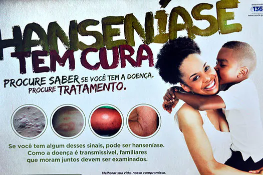 Hanseníase é tema de campanha no terminal da EMTU no Jabaquara