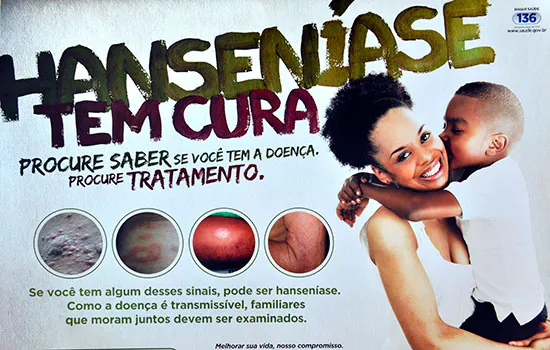 Hanseníase é tema de campanha no terminal da EMTU no Jabaquara