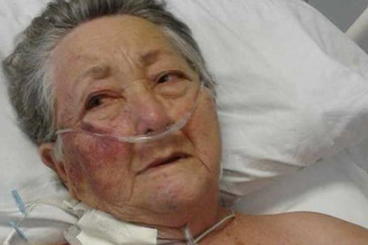 Enfermeiro é afastado após suspeita de agressão contra idosa de 78 anos