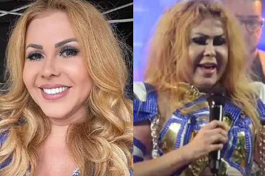 Joelma aparece com rosto inchado e preocupa fãs: “sequelas da covid”