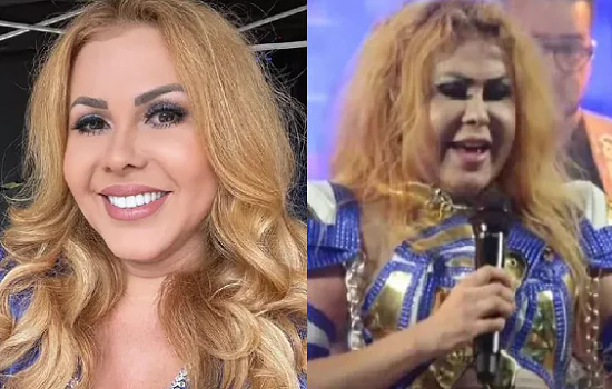 Joelma aparece com rosto inchado e preocupa fãs: “sequelas da covid”