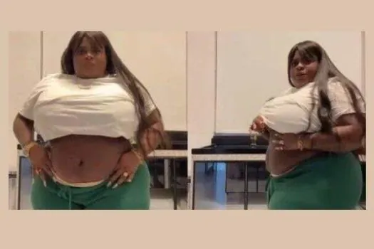 Jojo Todynho mostra como ficou sua barriga após cirurgia bariátrica