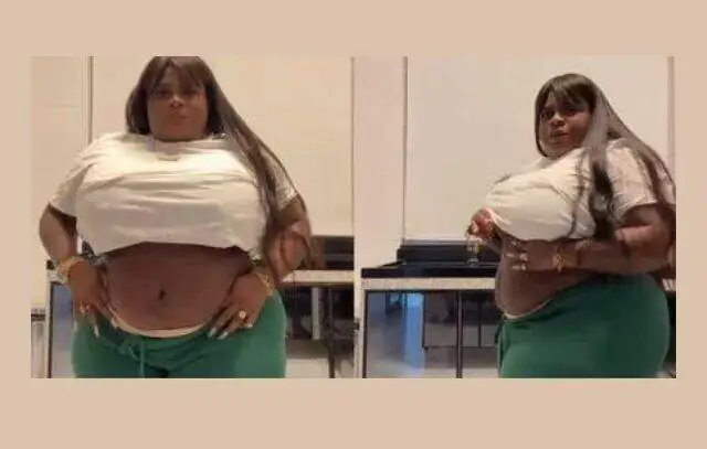 Jojo Todynho mostra como ficou sua barriga após cirurgia bariátrica