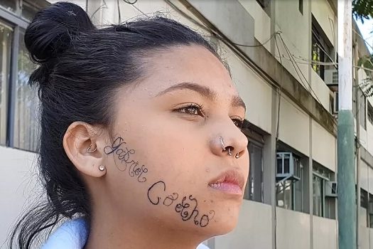 Jovem de Taubaté que teve o rosto tatuado à força inicia remoção da tatuagem