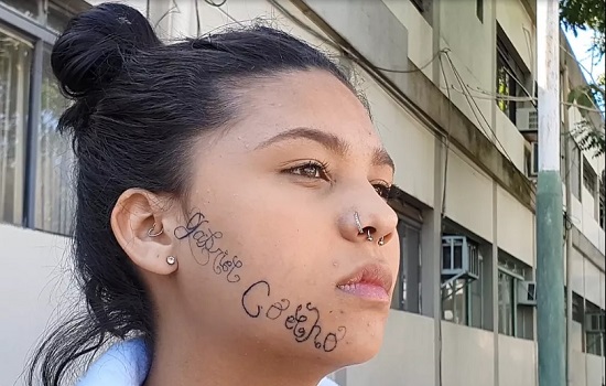 Jovem de Taubaté que teve o rosto tatuado à força inicia remoção da tatuagem