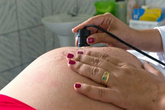 Gestante com dengue deve ser internada mesmo com sinais leves