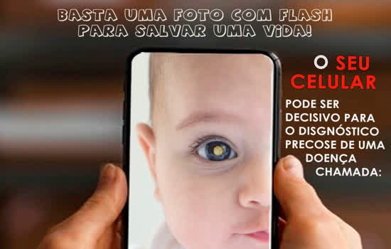 “Flash branco” em olho de criança pode ajudar a identificar câncer