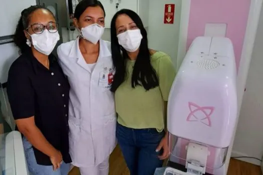 Carretas-móveis levarão laboratórios de mamografia para o interior São Paulo