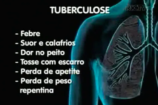 Registro de tuberculose que resiste a remédios triplica; já são 3 casos por dia