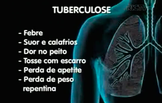 Registro de tuberculose que resiste a remédios triplica; já são 3 casos por dia