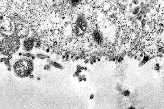 África do Sul detecta nova variante do coronavírus e estuda mutações