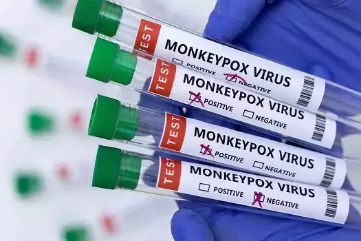 Anvisa analisa cinco pedidos de testes para diagnóstico de varíola dos macacos