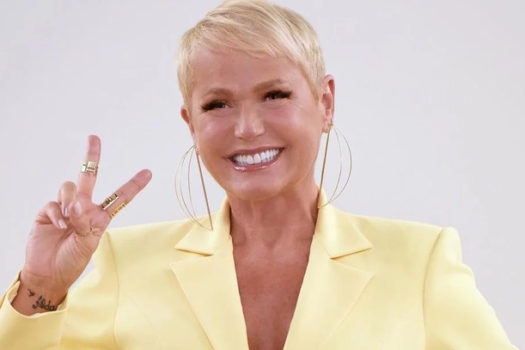 Xuxa Meneghel Passa por Cirurgia no Joelho e é internada